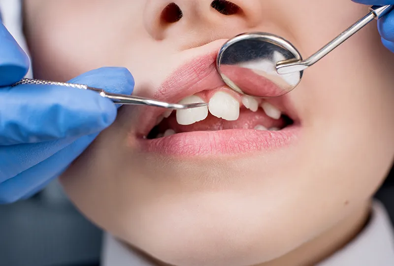 diş şekil bozuklukları bağcılar diş kliniği